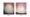 Before and After Dental Crowns 5