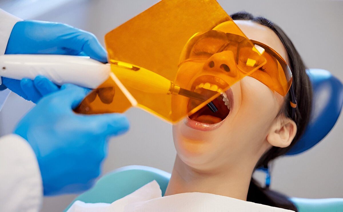 dental fillings near you