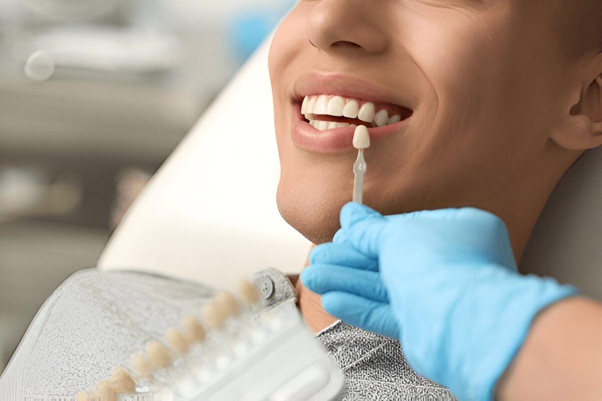 dental veneers in lendrum