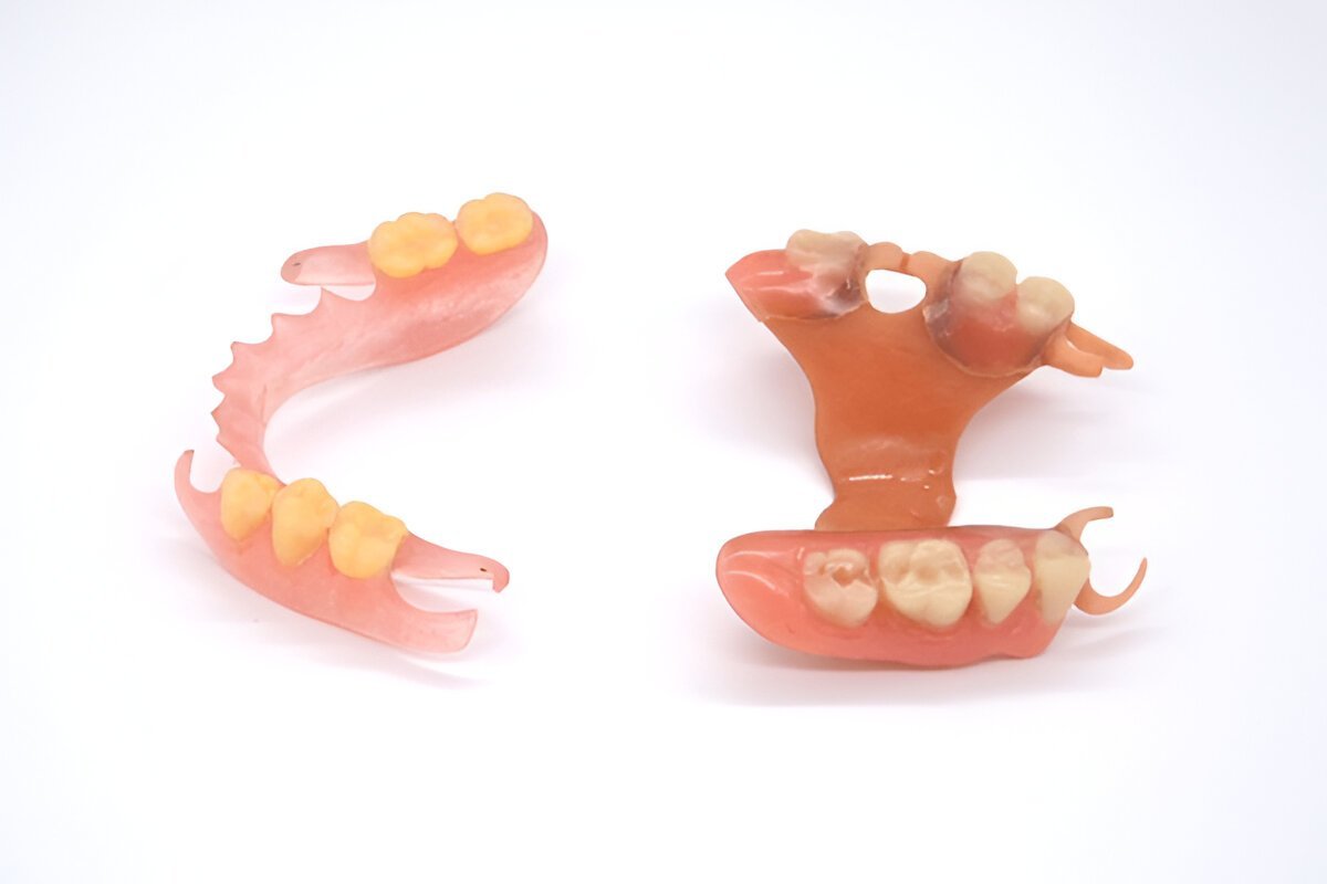 full partial dentures in lendrum